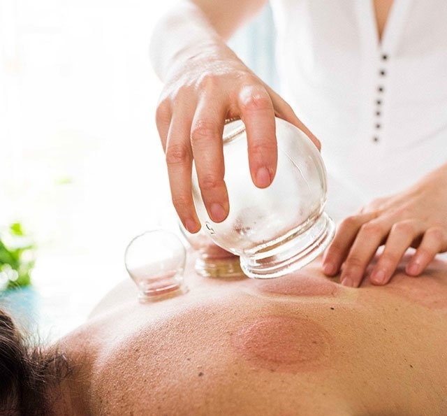 Benefits of cupping